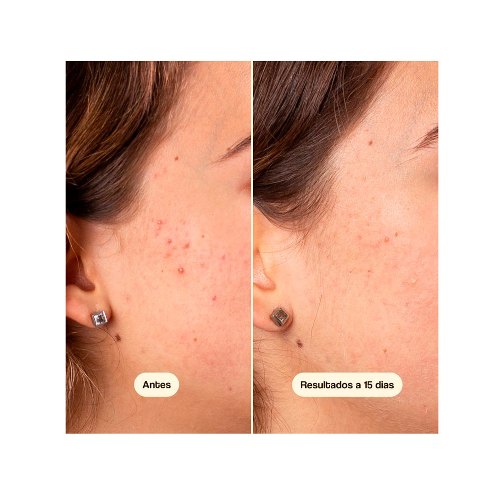 Freshly Cosmetics Azelaic Radiance Face Treatment