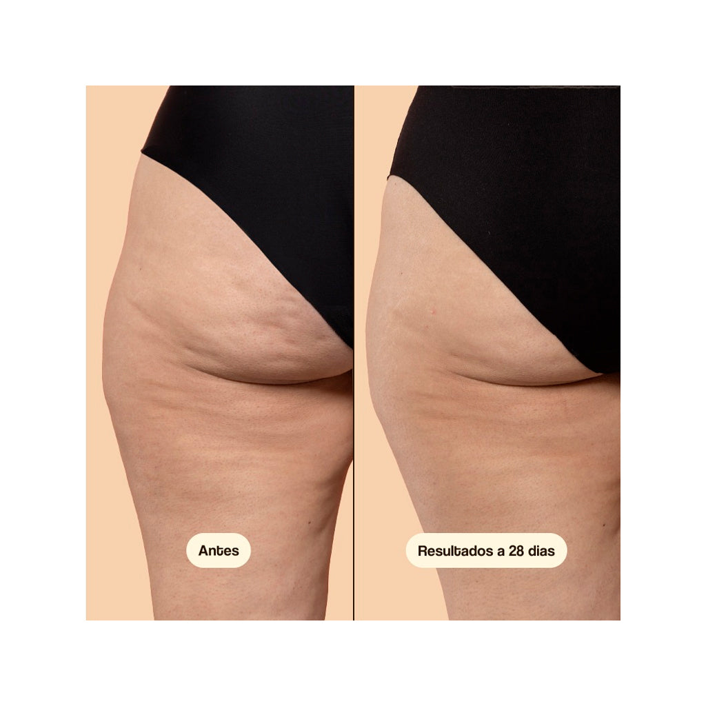 Freshly Cosmetics Beta-Burner Sculpting Treatment