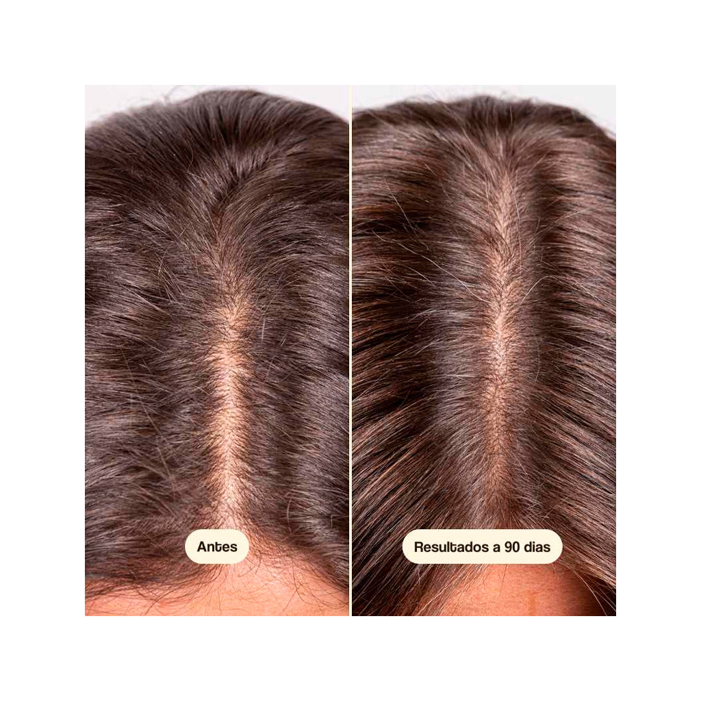 Hair Growth & Density Treatment