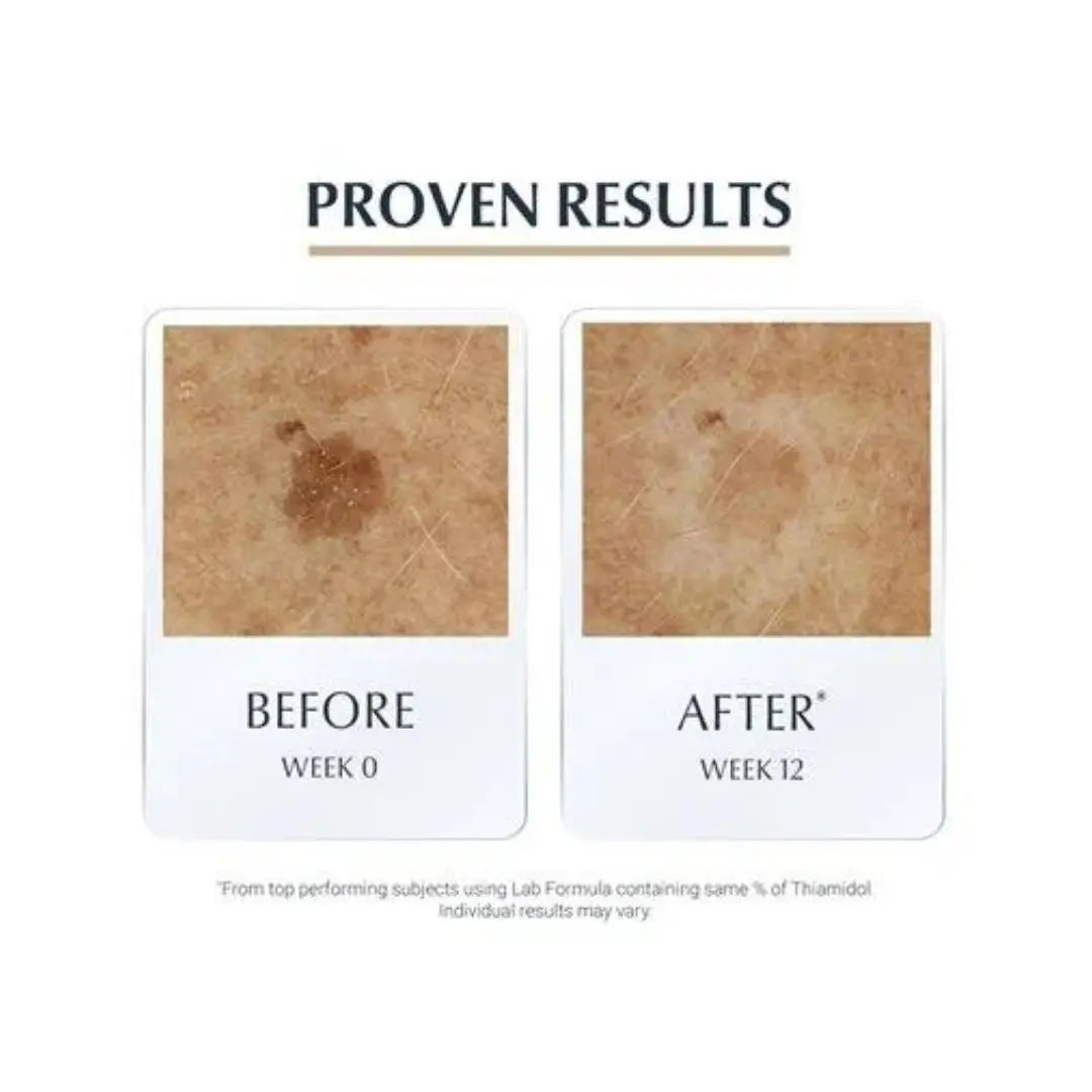Eucerin Sérum Hyaluron-Filler + Elasticity 3D
