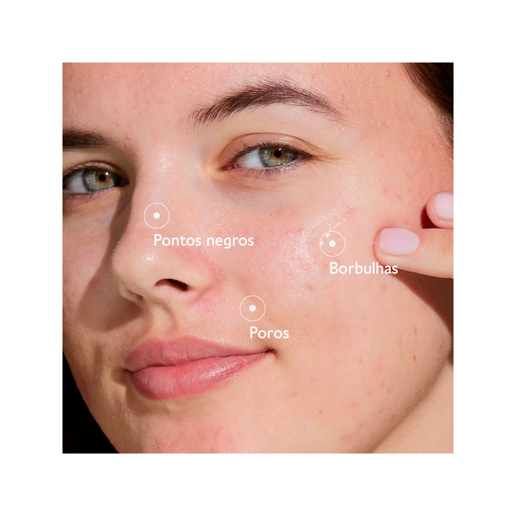 Sérum Salicílico Anti-imperfeições Vinopure Caudalie