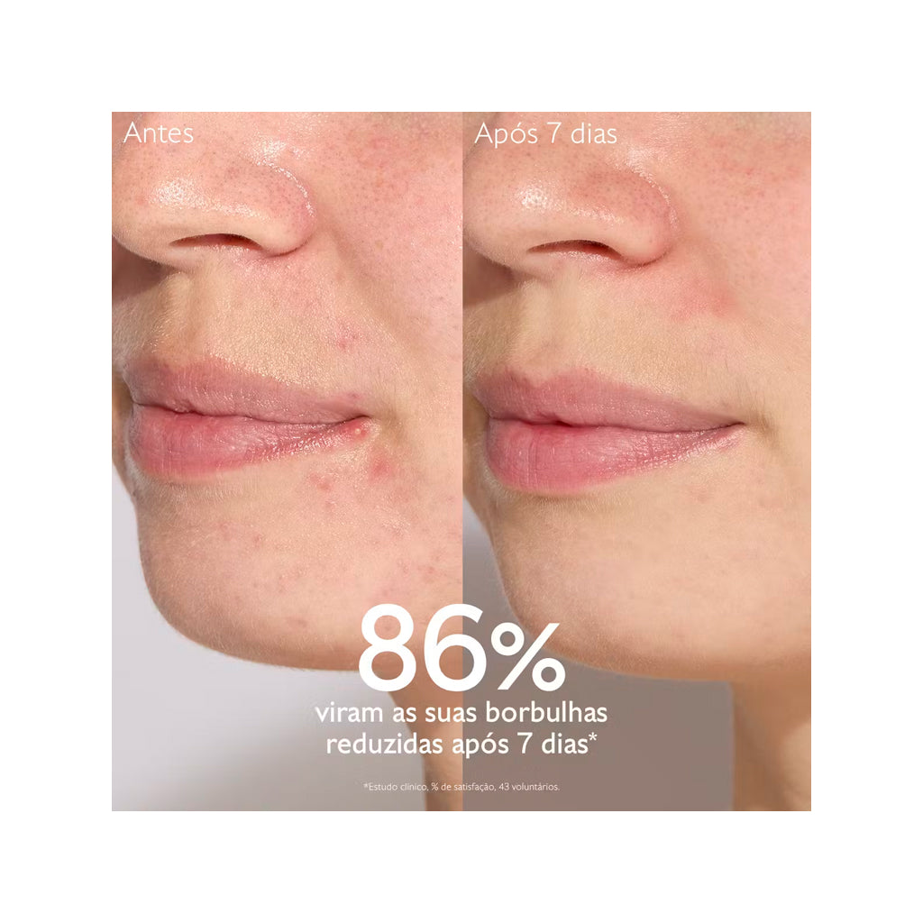 Caudalie Sérum Salicílico Anti-imperfeições Vinopure - Love my Pharma