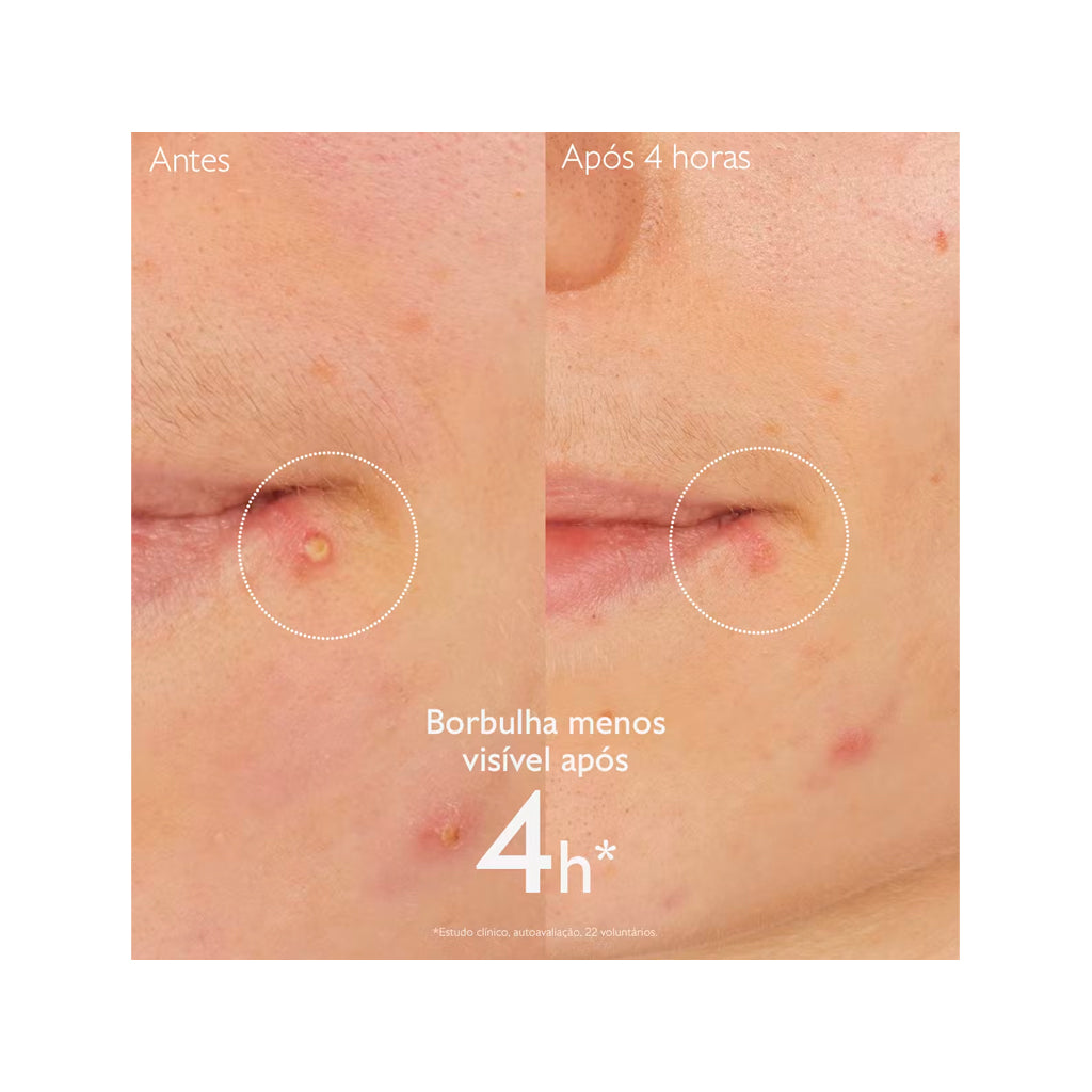 Caudalie Stop Borbulhas com Acido Salicílico Vinopure - Love my Pharma