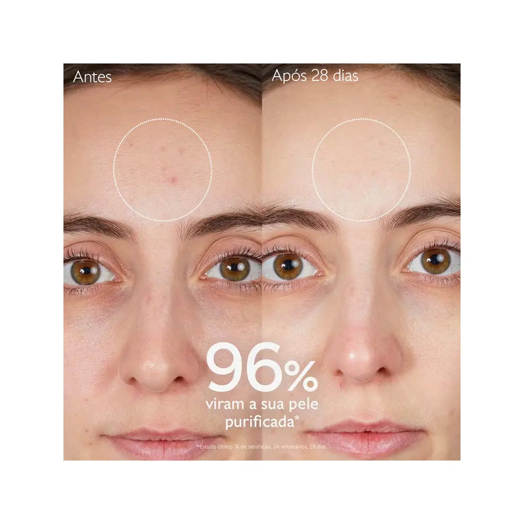 Caudalie Gel Limpeza Purificante com Acido Salicílico Vinopure