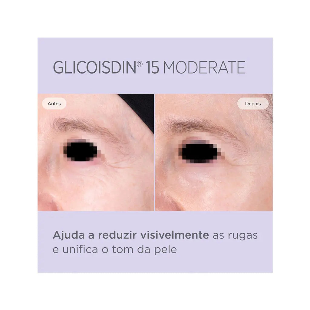 ISDINCEUTICS Gel Glicoisdin 15 Moderate