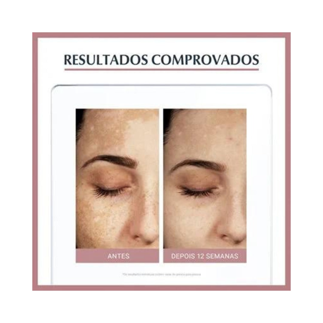 Sérum Despigmentante Anti-Pigment Eucerin