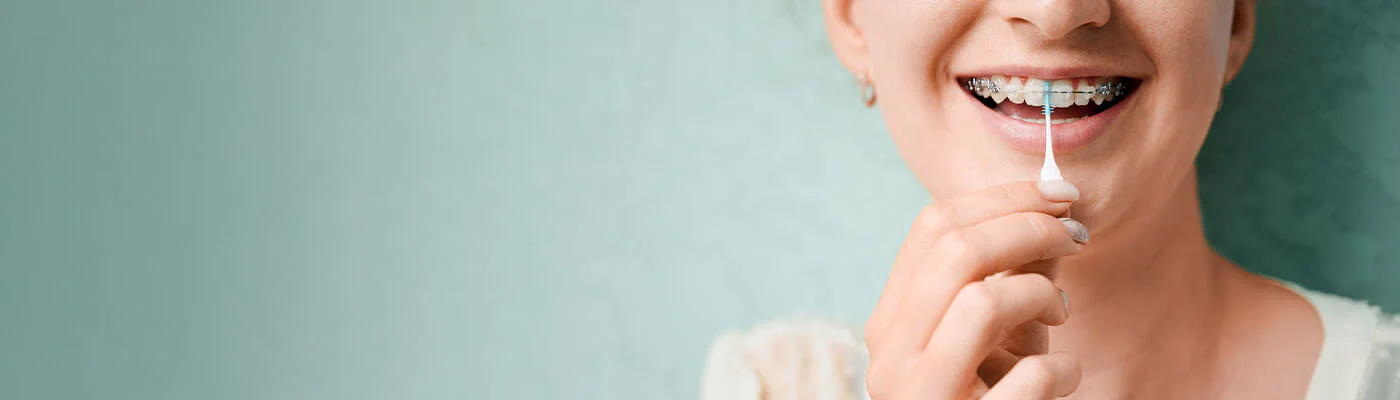 Ortodontia e Acessórios Interdentais