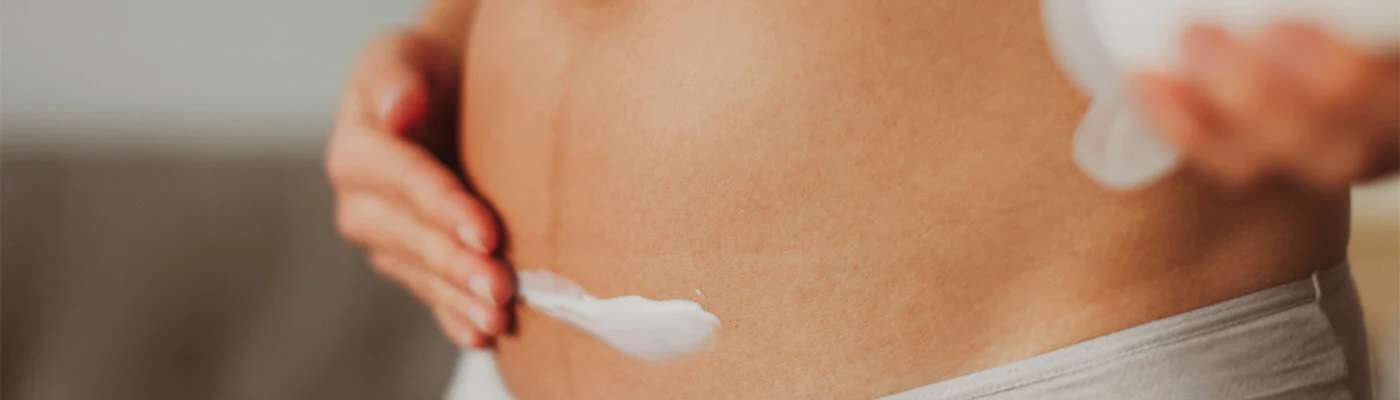 Antiestrias e Hidratação