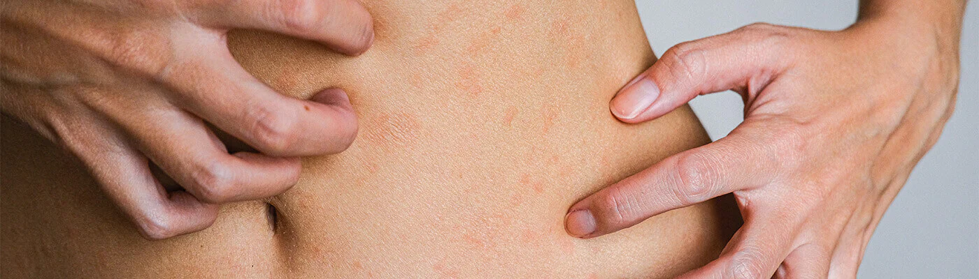 Cuidados Específicos Corpo