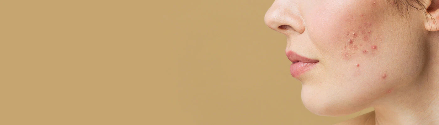 Cuidados Específicos Rosto