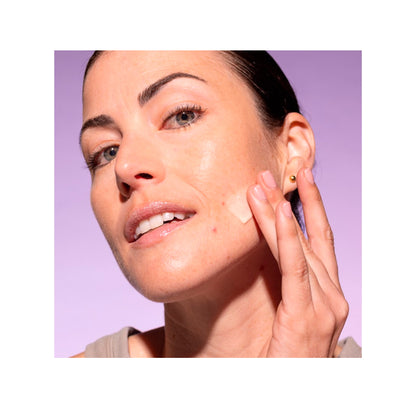 Tratamiento Facial Radiance con Ácido Azelaico