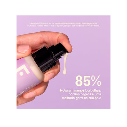 Tratamiento Facial Radiance con Ácido Azelaico