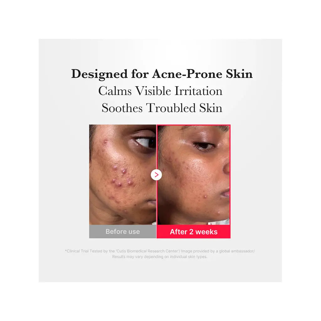 Medicube Hypochlorous Acid Daily Facial Spray | Love my Pharma