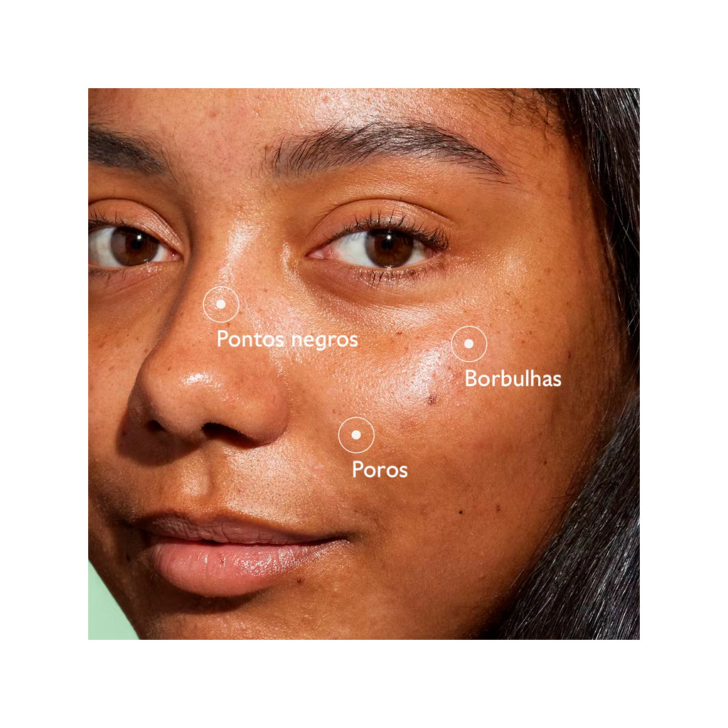 Sérum Salicílico Anti-imperfeições Vinopure