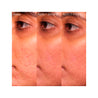 Sérum Salicílico Anti-imperfecciones Vinopure