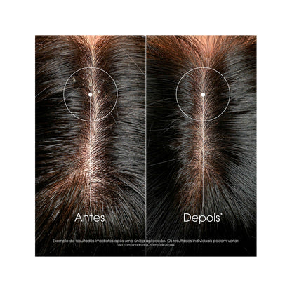 Loción Capilar Anticaspa de Galanga