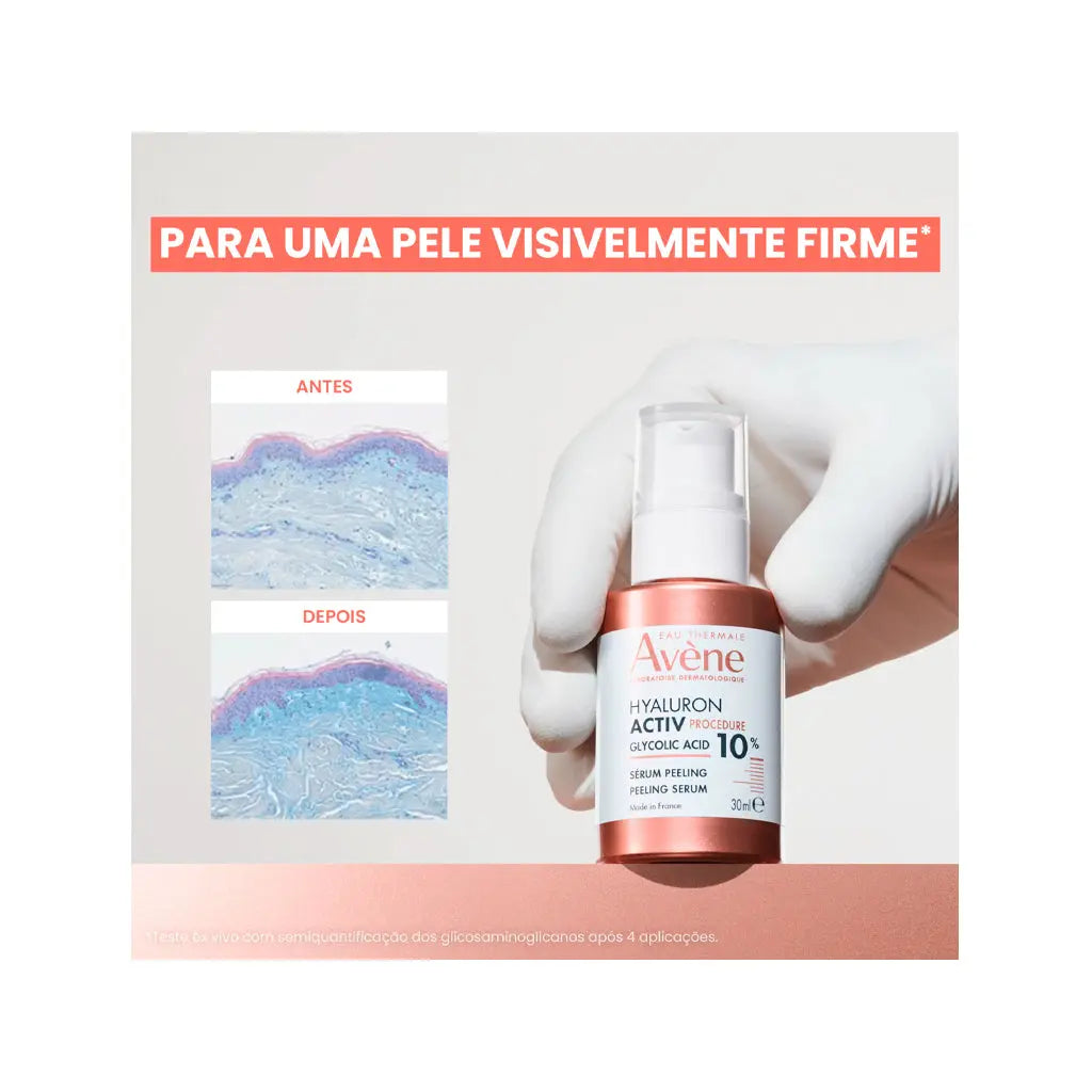 Avène Hyaluron Procedure Sérum Peeling | Love my Pharma