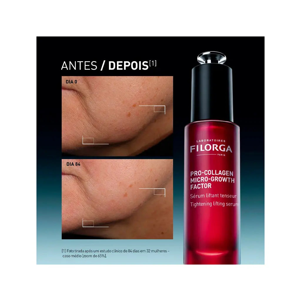 Filorga Pro-Collagen Micro-Growth Factor Sérum | Love my Pharma