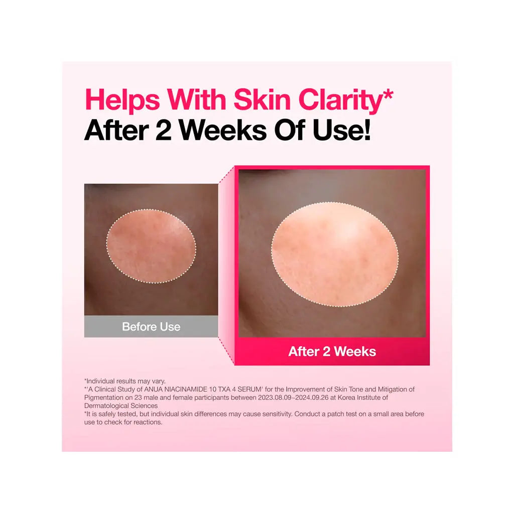 Anua Niacinamide 10% + TXA 4% Serum | Love my Pharma