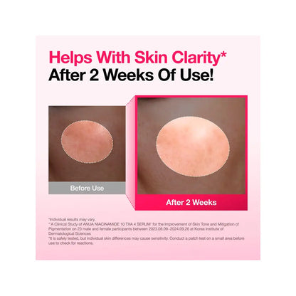 Anua Niacinamide 10% + TXA 4% Serum | Love my Pharma