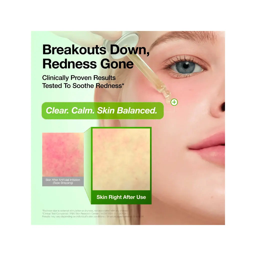 Anua Azelaic Acid 10 Hyaluron Redness Soothing Serum | Love my Pharma