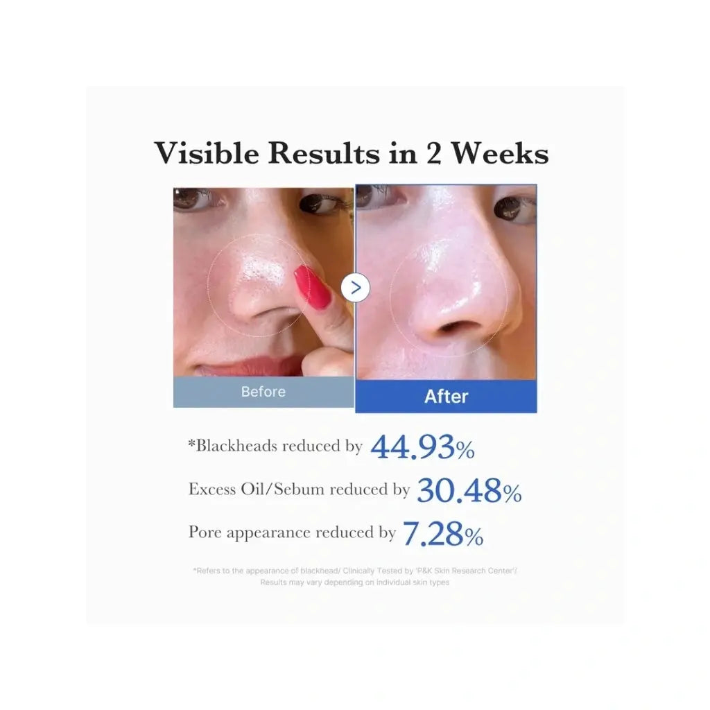 Medicube Zero Pore Pad 2.0 | Love my Pharma