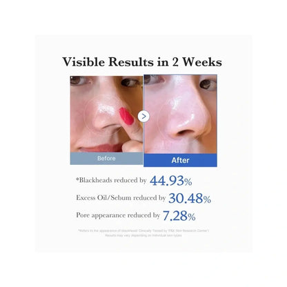 Medicube Zero Pore Pad 2.0 | Love my Pharma
