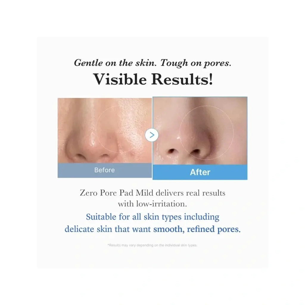 Medicube Zero Pore Mild Pad | Love my Pharma