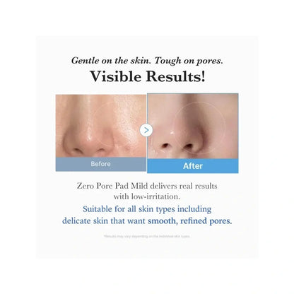 Medicube Zero Pore Mild Pad | Love my Pharma